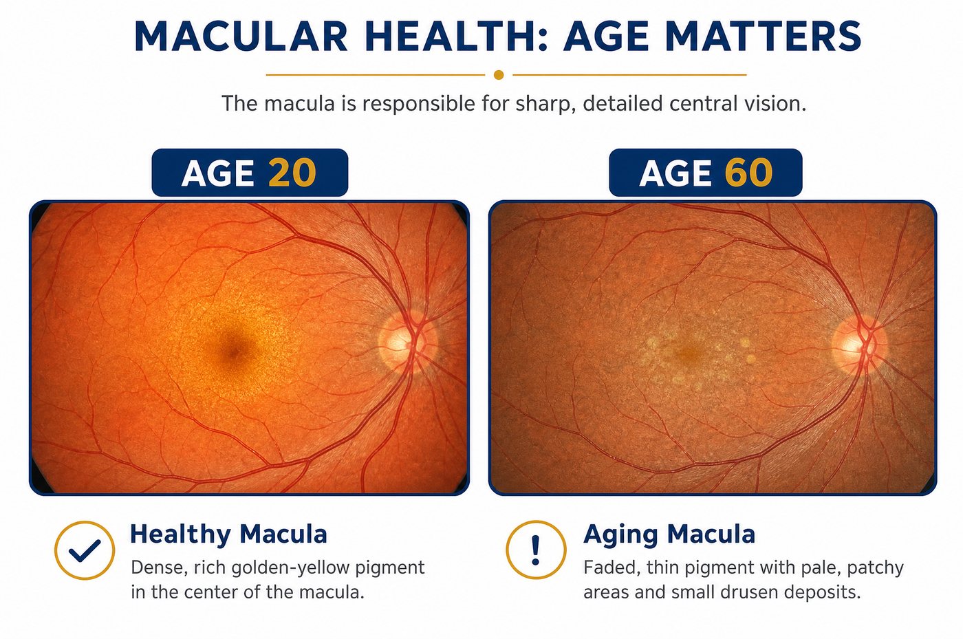 Macular pigment at 20 versus 60