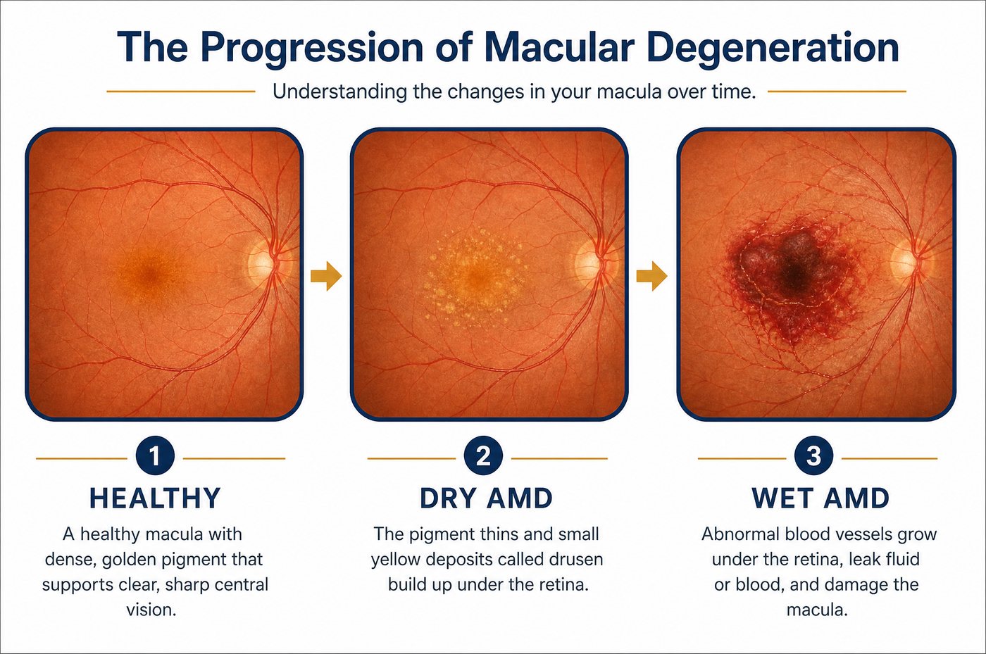 Dry to wet progression