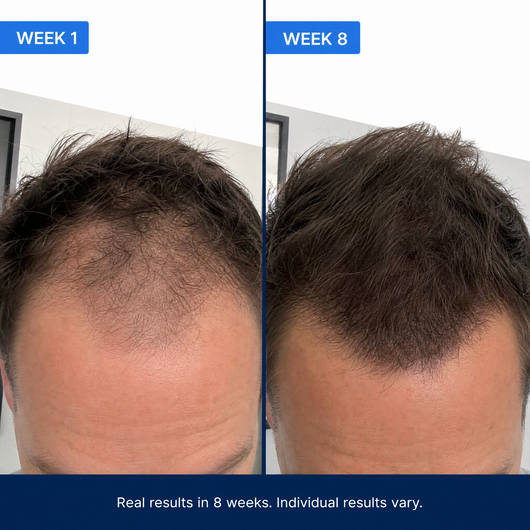 Advanced Hair Growth Roll-on Serum